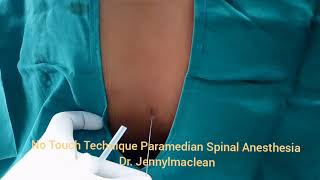 No Touch Technique Spinal Anesthesia by Paramedian Technique [upl. by Ing]