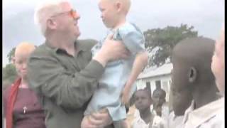 Canadian Assists Albinos in Tanzania [upl. by Notsuj]