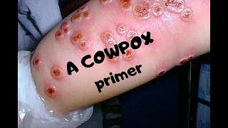 COWPOX A primer on a now rare infection [upl. by Tymothy892]