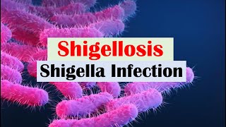 Shigellosis Shigella “A Cause of Bloody Diarrhea” Pathophysiology Symptoms Diagnosis Treatment [upl. by Eliathan237]