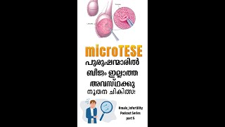 Male Infertility Treatment MicroTESE Explained by Experts  Cochin Urology Podcast  Part 5 [upl. by Rocray]