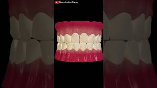 Dental Crown Procedure shorts [upl. by Clerc]