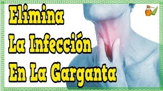 Que Tomar Para El Dolor De Garganta  Elimina La Infeccion En La Garganta [upl. by Esorrebma]