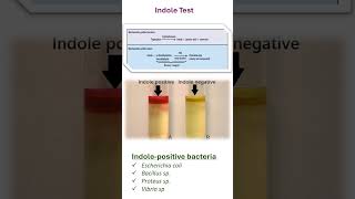 INDOLE TEST [upl. by Curhan488]