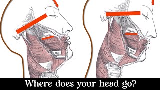 Indirectly Moving Your Maxilla Forward and Up [upl. by Nothsa]