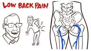 Low Back Pain [upl. by Theall]