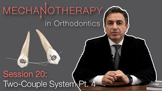 Mechanotherapy in Orthodontics TwoCouple System Pt 4 [upl. by Rosamund]