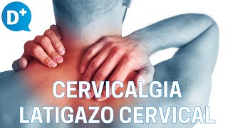 Causas y tratamiento de la cervicalgia y del latigazo cervical [upl. by Ecenaj]