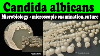 Candida albicans microbiology  microscopic examinationcuturelaboratory diagnosis [upl. by Attemaj926]