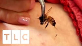 15 Bee Stings A Day  My Strange Addiction [upl. by Antoine]