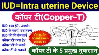 Intrauterine Device IUD  IUD for pregnancy control Class 12 Biology copper t ke fayde aur nuksan [upl. by Atikihc]