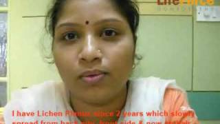 Lichen Planus treated by Dr Rajesh Shah at Life Force [upl. by Win]