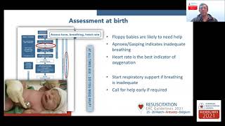 Newborn Life Support  ERC Guidelines 2021 [upl. by Franklin]