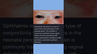 What is Ophthalmia Neonatorum [upl. by Festus419]