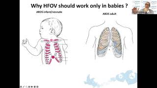 High Frequency Oscillatory Ventilation for Infants in the PICU Understanding When and How [upl. by Nosylla]