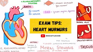 Cardiac Murmurs and Maneuvers Valsalva Handgrip Squatting Inspiration  Quiz [upl. by Rogerson]