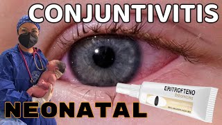 Conjuntivitis Neonatal Prevención con Eritromicina USMLE Pearls [upl. by Singer]