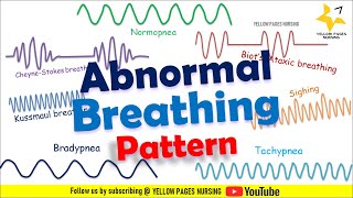 ABNORMAL BREATHING PATTERN  Apnea  Bradypnea  Tachypnea  Ataxic  Sighing  CheyneStokes [upl. by Brianne]