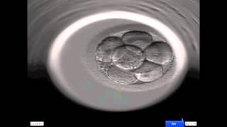 Entwicklung eines menschlichen Embryos [upl. by Plantagenet]