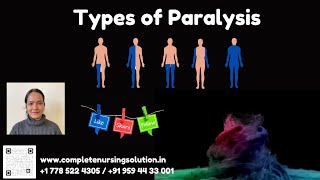 Types of Paralysis amp Its Nursing care nclex nclexpracticequestions paralysis paralysistreatment [upl. by Tobey]