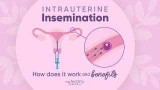 Intrauterine Insemination How Does It Work amp Benefits  The Fertility Center [upl. by Nibor221]