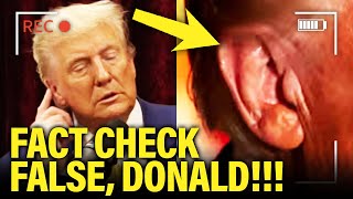 Trump SO CALLED EAR INJURY Claim BACKFIRES in His FACE [upl. by Abocaj]