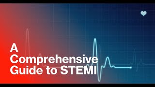 STElevation Myocardial Infarction STEMI A Comprehensive Guide to Understanding and Recognition [upl. by Popper]