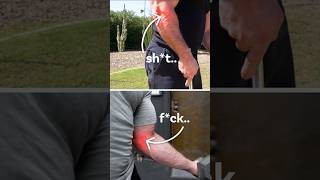 Got Tennis or Golfers Elbow This is How You Fix Them golferselbow tenniselbow elbowpain [upl. by Corrina]