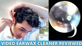 Ear Specialist Reviews Home Ear Wax Removal Camera Bebird Earokay Ear Cleaner [upl. by Adaline]