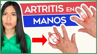 Artritis en las Manos Síntomas causas y Como Curar las Manos [upl. by Prevot149]