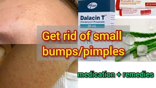 How to get rid of small bumps pimples after waxing and threading [upl. by Soisanahta533]