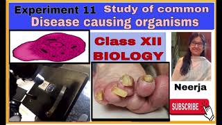 Study of common disease causing organisms class12Experiment 11 spottingBiology by Neerja [upl. by Skvorak]