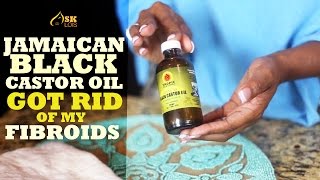 Get Rid of Fibroids with Jamaican Black Castor Oil [upl. by Ardnnek]