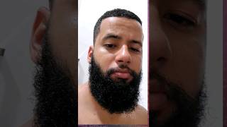 7 MESES USANDO MINOXIDIL  e contando EVOLUÇÃO MINOXIDIL minoxidil barba [upl. by Anomas498]