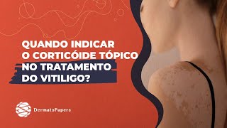 Corticóides tópicos muito indicados para os casos de vitiligo localizado [upl. by Iron]