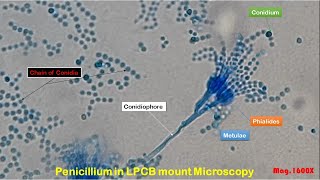 Penicillium in LPCB Mount Microscopy showing Condia ConidiophoresPhialidesmetulae Septate hyphae [upl. by Iturk]