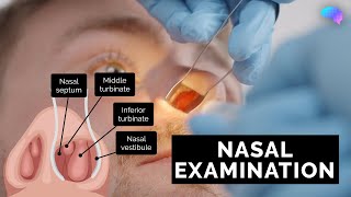 Nasal Examination  Nose Examination  OSCE Guide  UKMLA  CPSA [upl. by Nosdrahcir634]