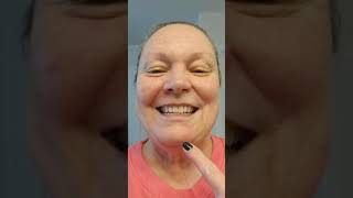 Healing on day 30 after a 21 day 5 Fluorouracil treatment for Basal Cell Carcinoma 2222023 [upl. by Damha]