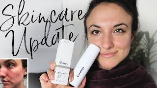 SKINCARE UPDATE The Ordinary vs Curology [upl. by Pascoe355]