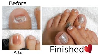 NO Toenails NO Problem  Make POLYGEL TOENAILS w Dual Forms  Yayoge Polygel [upl. by Verner]