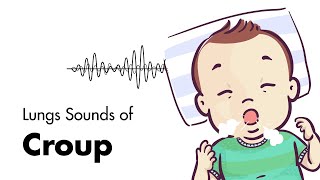 Sounds of Croup Laryngotracheitis  Lung Sounds  MEDZCOOL [upl. by Boccaj205]