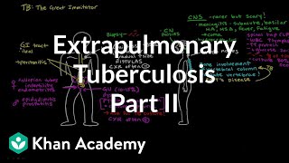 Extrapulmonary TB Part 2  Infectious diseases  NCLEXRN  Khan Academy [upl. by Ennaisoj]