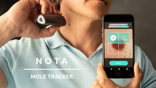 Nota Mole Tracker  Take Charge of Your Skin At Home  HOW TO TRACK amp DETECT MOLE 2020 [upl. by Pitzer924]