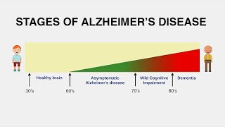 Diagnosing Alzheimer’s Disease [upl. by Mauve771]