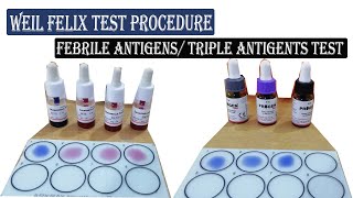 Weil Felix Test ।। Febrile Antigens Triple Antigens Test Procedure Full Details [upl. by Alihet]