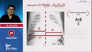 Icc en pediatría INDICE DESCRIPCIONEtiologíaClínicaRXTTO PEDIATRÍA QX MEDIC 2023 [upl. by Aremat]