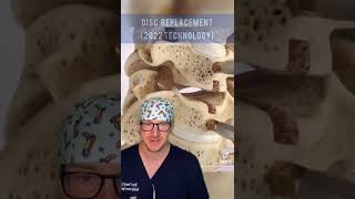 Disc Replacement Technology in 2022 Texan Spine Surgeon Explains 🤠 [upl. by Laundes]