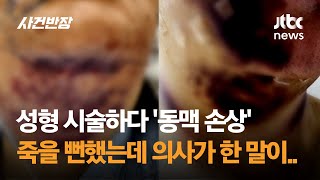 성형 시술하다 동맥 손상됐는데 의사가 한 말이…  JTBC 사건반장 [upl. by Mila]