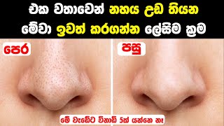 Easy Ways to Remove Blackheads and Whiteheads [upl. by Pritchett]