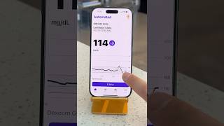 ad for omnipod  The Omnipod 5 App for iPhone is pure MAGIC [upl. by Gorga]